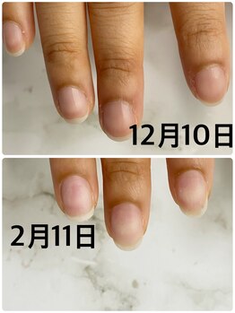 リフレシア(Rifrecia)/つめがグングン伸びる