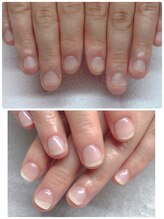 スマイルニコ(smile nico)/深爪矯正【長さ出し有】自爪風