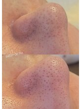 サロンドリー(salon de Re)/超音波エクストラクション