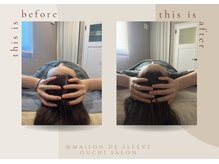メゾンドスリーブ(Maison de Sleeve)/BeforeAfter