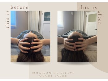メゾンドスリーブ(Maison de Sleeve)/BeforeAfter