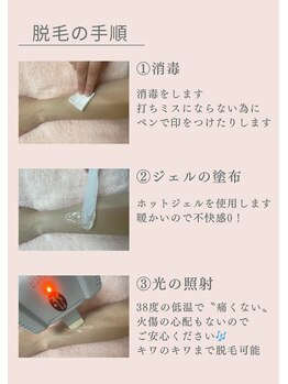 ディオーネ 上越南高田店(Dione)/脱毛手順 1