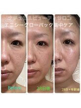 ナチュラルビューティサロン/エニシーグローパック集中ケア！