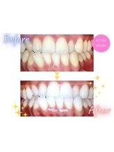 エクシアホワイト SOKA(ecxia white)/