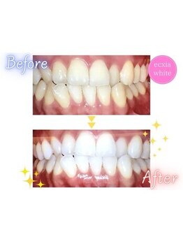 エクシアホワイト SOKA(ecxia white)/