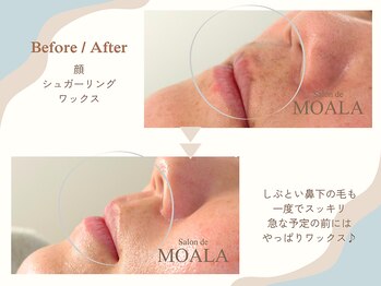 サロンドモアラ(Salon de MOALA)の写真/産毛＆角質をその場でオフ！パッと明るくトーンアップ、つるんと発光☆お顔全体、滑らかなたまご肌へ