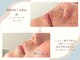 サロンドモアラ(Salon de MOALA)の写真/産毛＆角質をその場でオフ！パッと明るくトーンアップ、つるんと発光☆お顔全体、滑らかなたまご肌へ