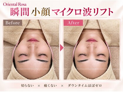 オリエンタルローザ 表参道(Oriental Rosa)の写真