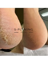 ベルネイル(Belle Nail)/足裏角質ケア