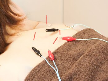 240鍼灸マッサージ院 麻布十番/【鍼灸×整体】最新の鍼通電