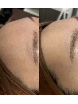 ソレラ(sorelle)/フェイシャルワックス