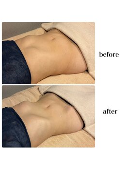 ビューティーサロン ラグジューム(Beauty salon Laxum)/赤岩式腸けずり