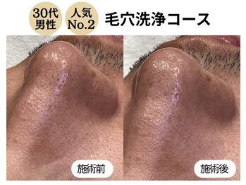 ディレイア ザ コスメ 有楽町マルイ店(direia the cosme)/メンズ/月１回/［有楽町］