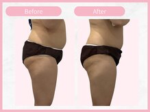 アールエイチビー 藤沢店(RHB)/