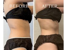 ヨサパーク アーバンヘブン 目黒(YOSA PARK Urban Heaven)/短期期間で集中ダイエット！