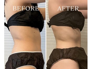 ヨサパーク アーバンヘブン 目黒(YOSA PARK Urban Heaven)/短期期間で集中ダイエット!