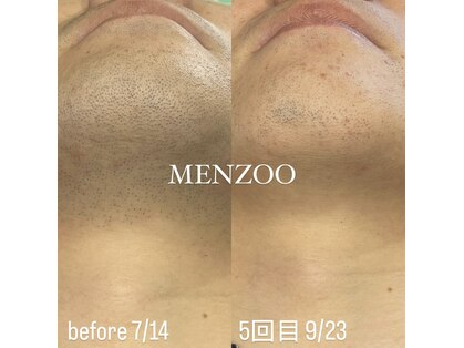 メンズー(MENZOO)の写真