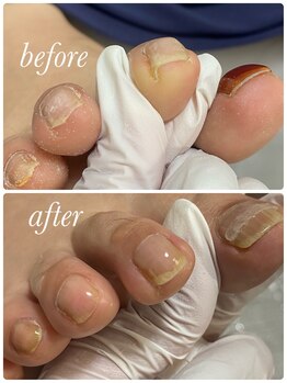 リゼラアンドコー 布施店/要注意！爪の切り残し！