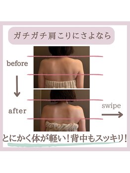 ミトラ(MITRA)/肩こり解消！スッキリ美ボディ♪