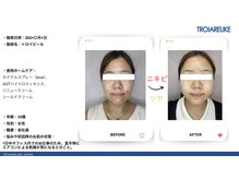 リトルーム(Litroom: from Seoul)/センシティブ管理