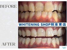 ホワイトニングショップ熊本東店/