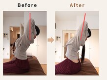 ハリデイズ/50代-お顔のむくみ、肩こり