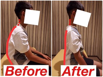 若松整体院若林区院/ビフォーアフター!