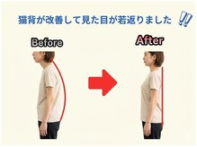 のなか整体院/整体 Before→After