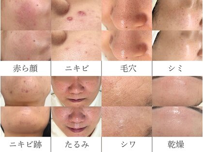 ジェム(gemme)の写真