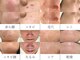 ジェム(gemme)の写真