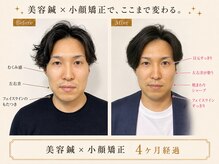 カドモリ 心斎橋(KADOMORI)の雰囲気（美容鍼/大阪美容鍼/心斎橋美容鍼/本町美容鍼/四ツ橋/小顔矯正）