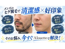 アルエット 旭川駅前店(Alouette)の雰囲気（濃いヒゲ・青ヒゲ撃退！清潔感UP！メンズ脱毛も大歓迎♪）