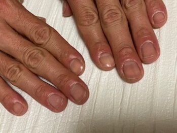 エステティックサロン ガーデニア(Gardenia)/ネイル画像