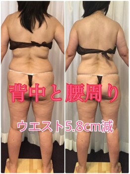 ボディエステティック アクアオーラ 富山店/背中と腰まわり