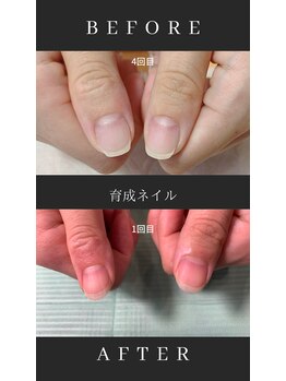 最強のネイルケア育成ネイル