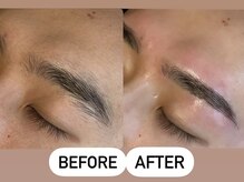 ソーレエルーナ(SOLE e LUNA)/メンズ 新宿 眉毛 ワックス 脱毛