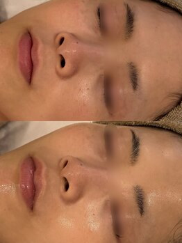 セレニテ(Serenite)/