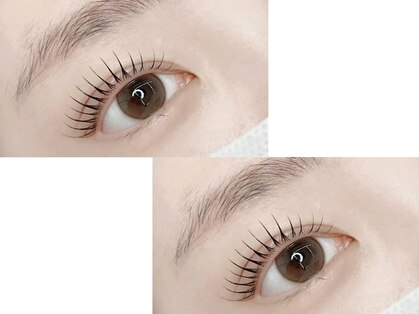 アイビューティ デイジー(Eye Beauty Daisy)の写真