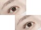 アイビューティ デイジー(Eye Beauty Daisy)の写真