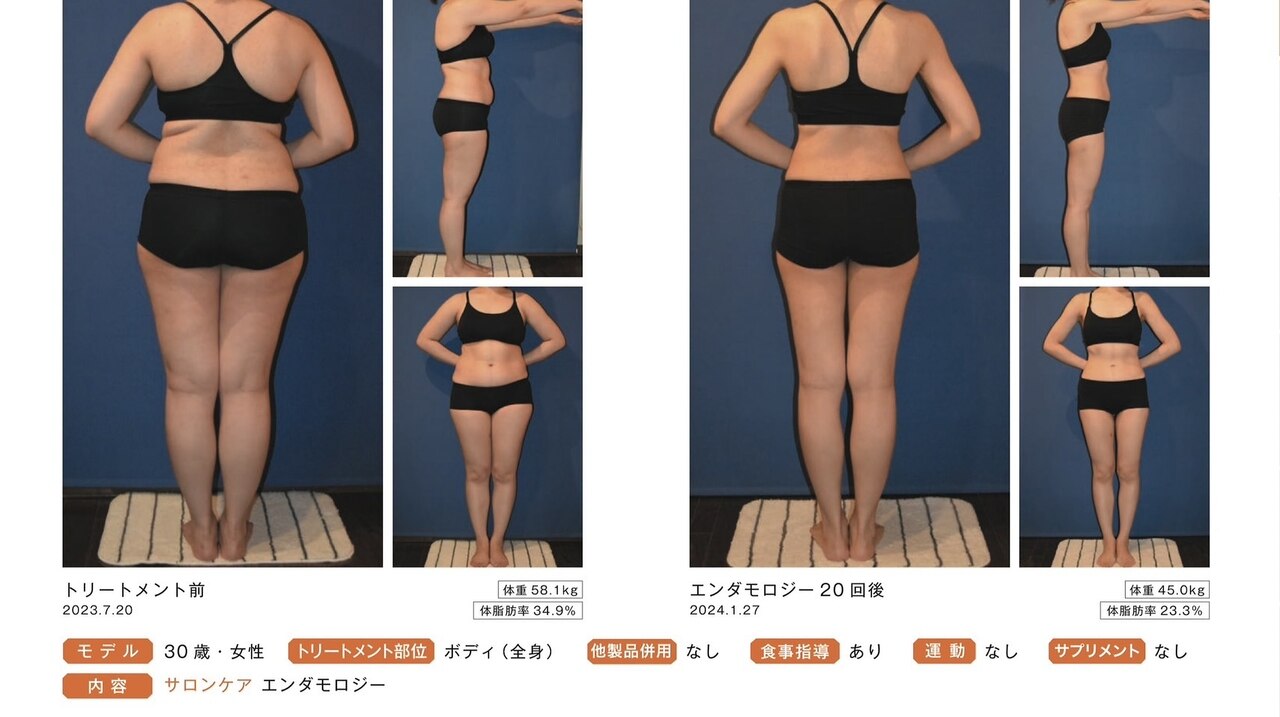 熊本市中央区でエンダモロジーが人気のエステサロン｜ホットペッパー