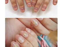 ココ ネイル サロン アンドスクール(COCO.NAIL SALON＆SCHOOL)/爪噛み　3ヶ月で綺麗な指先へ