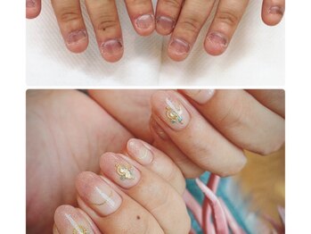 爪噛み 3ヶ月で綺麗な指先へ