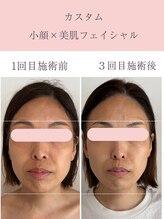 シンナリ(Shinnari)/カスタム小顔×美肌フェイシャル