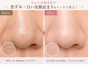 ラフェリア 弘明寺(Raffelia)/フェイスWAX／毛穴施術