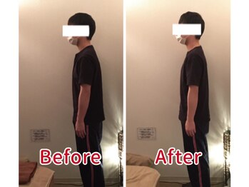 ほぐし屋さん/猫背の姿勢が一回でここまで変化