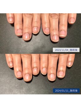 ブラン(blanc)/8.自爪育成