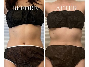 ヨサパーク アーバンヘブン 目黒(YOSA PARK Urban Heaven)/短期期間で集中ダイエット!