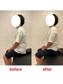 ナオル整体 福岡香椎院(NAORU整体)/20代男性施術事例【猫背】