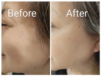 ジーサララ 用賀店(G.Sarara)/オイルマッサージ×小じわ予防