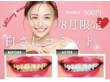 エクシアホワイトニング 石巻店